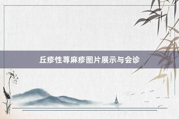 丘疹性荨麻疹图片展示与会诊